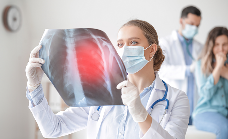 Tüberküloz Hastalığının Belirtileri Nelerdir?